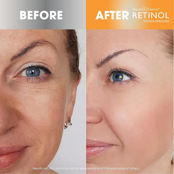 Retinol Vitamin C Serum - 30 ml