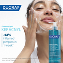 Keracnyl Foaming Gel-9