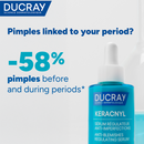 Ducray Keracnyl Anti-Blemishes Regulating Serum - 30 ml-3