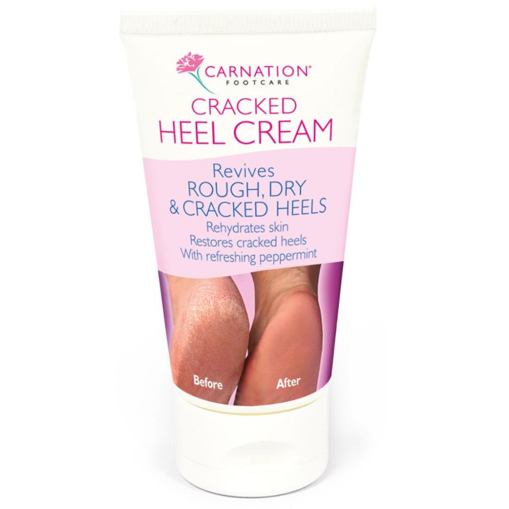 Carnation Cracked Heels Cream - 50 ml